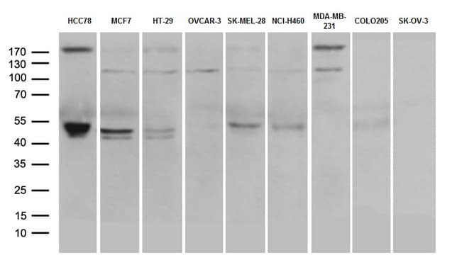 CD274 / B7-H1 / PD-L1 Antibody (aa19-290, clone OTI9E10)