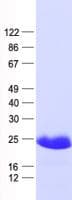 Human VIP Protein (Recombinant His, N-Terminal)