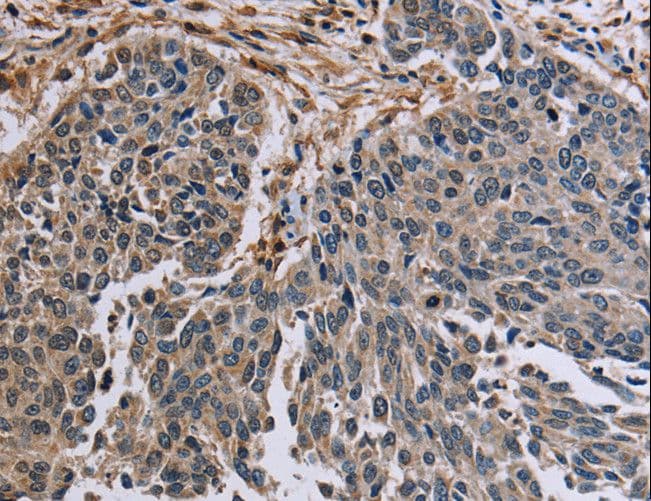 PNPT1 Antibody