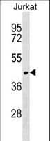 RUNDC3A Antibody (aa130-157)