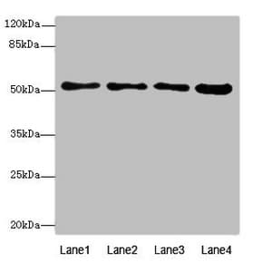 HSBLMHC1 / BTNL2 Antibody