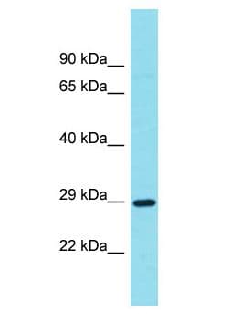 METRNL Antibody (aa32-81)