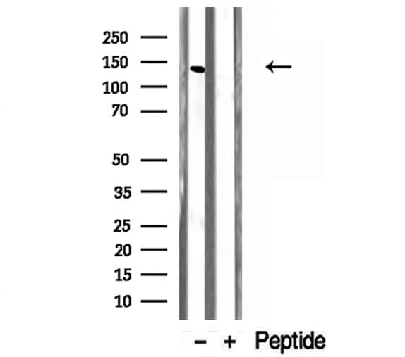 Polyclonal Rabbit anti-Human NNA1 / AGTPBP1 Antibody (IHC, WB)