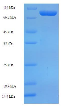 Human EME1 Protein (Recombinant His-SUMO)