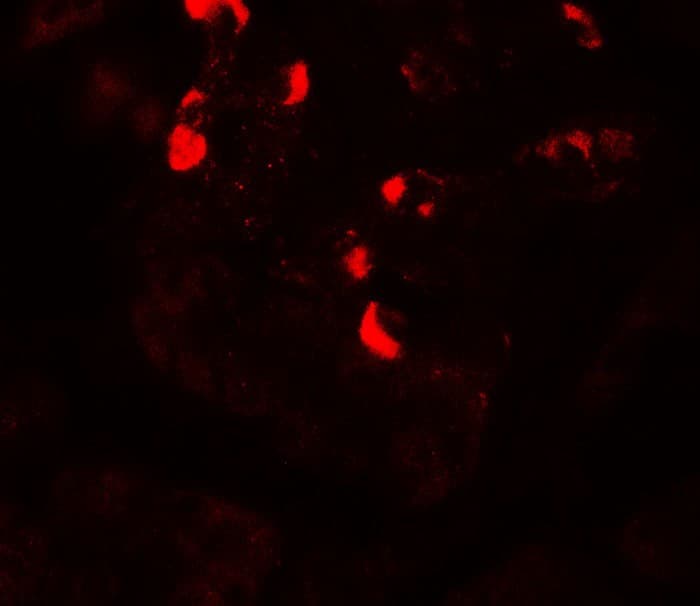 IHC-plus™ GLIPR1L1 Antibody