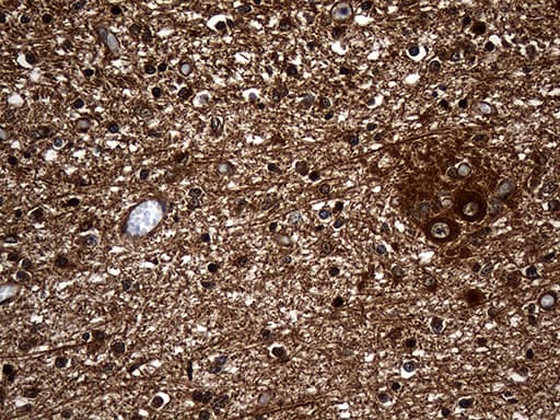 GNPAT / DHAP-AT Antibody (clone OTI1E7)