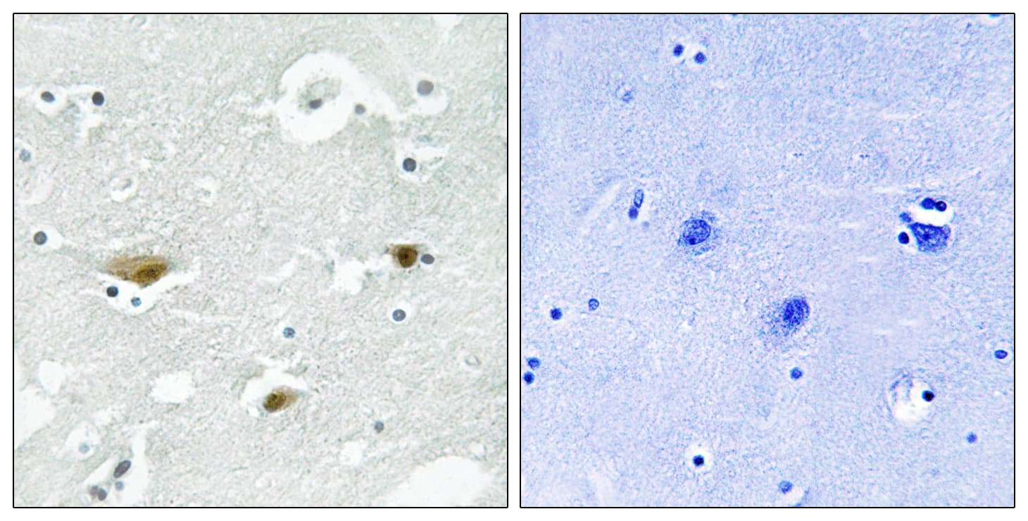 STK39 / SPAK Antibody (phospho-Ser325)