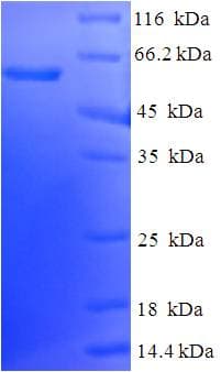 Human ERP44 Protein (Recombinant His-SUMO)