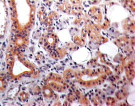 EPS8 Antibody (aa701-882, clone 18F5B11)