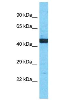 RNH1 Antibody (aa151-200)
