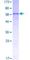 Human ANGPTL5 Protein (Recombinant GST)