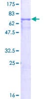 Human GPA33 / A33 Protein (Recombinant GST)
