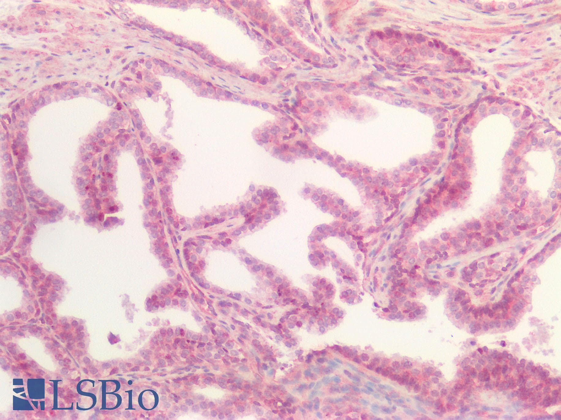 TREM2 / TREM-2 Antibody