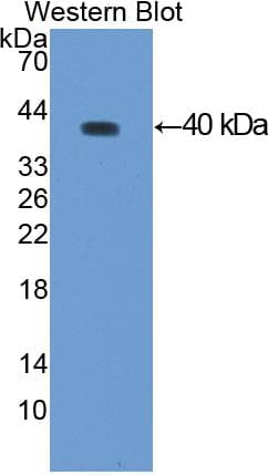 GSN / Gelsolin Antibody (aa432-780, APC)