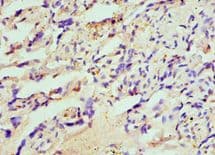 HIP1 Antibody (aa410-690)