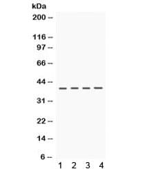 CSNK1A1 / CK1 Alpha Antibody