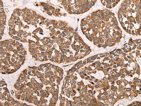CAD Antibody