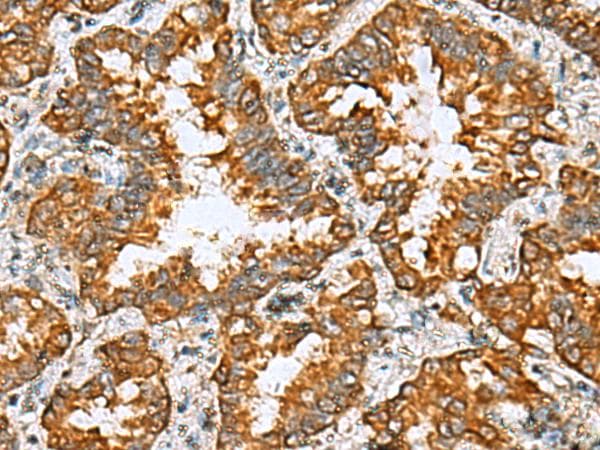 TMED10 / TMP21 Antibody