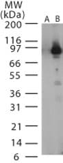 LF / Lethal Factor Antibody (aa290-306)