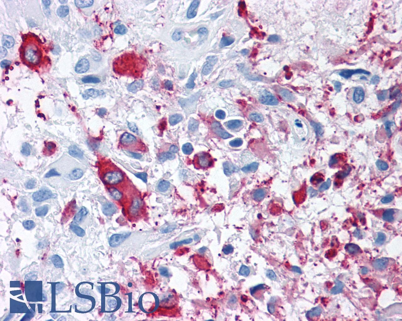PathPlus™ Polyclonal Rabbit anti-Human FZD3 / Frizzled 3 Antibody (N-Terminus, IHC)