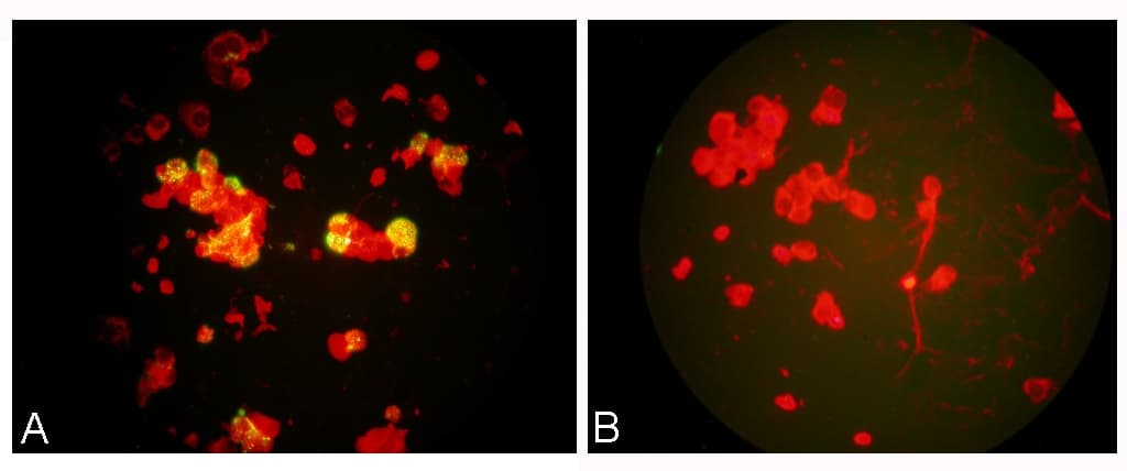 Monoclonal Mouse anti-Virus HMPV / Metapneumovirus Antibody (clone HMPV33, IF)