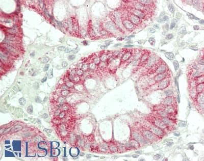PathPlus™ NGF Antibody (Leu82)