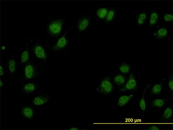 Monoclonal Mouse anti-Human TIP120 / CAND1 Antibody (clone 5D7, IHC, IF, WB)