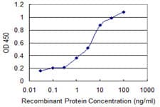 Monoclonal Mouse anti-Human RCBTB2 Antibody (clone 2G4, WB)