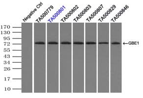 GBE1 Antibody (clone OTI3B4)