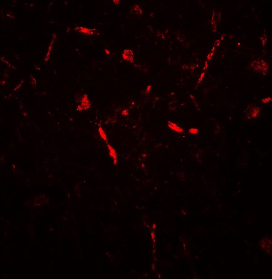 IHC-plus™ Polyclonal Rabbit anti-Human APPBP2 Antibody (IHC, IF, WB)