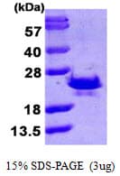 Human SRI / Sorcin Protein (Recombinant His)