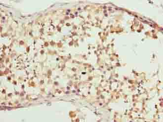 CFAP52 / WDR16 Antibody