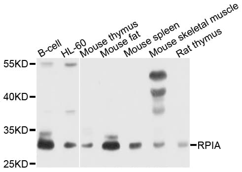 RPIA / RPI Antibody