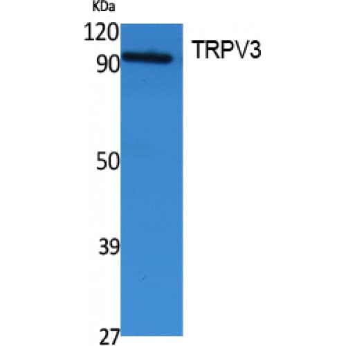 Polyclonal Rabbit anti-Human TRPV3 Antibody (Internal, WB)