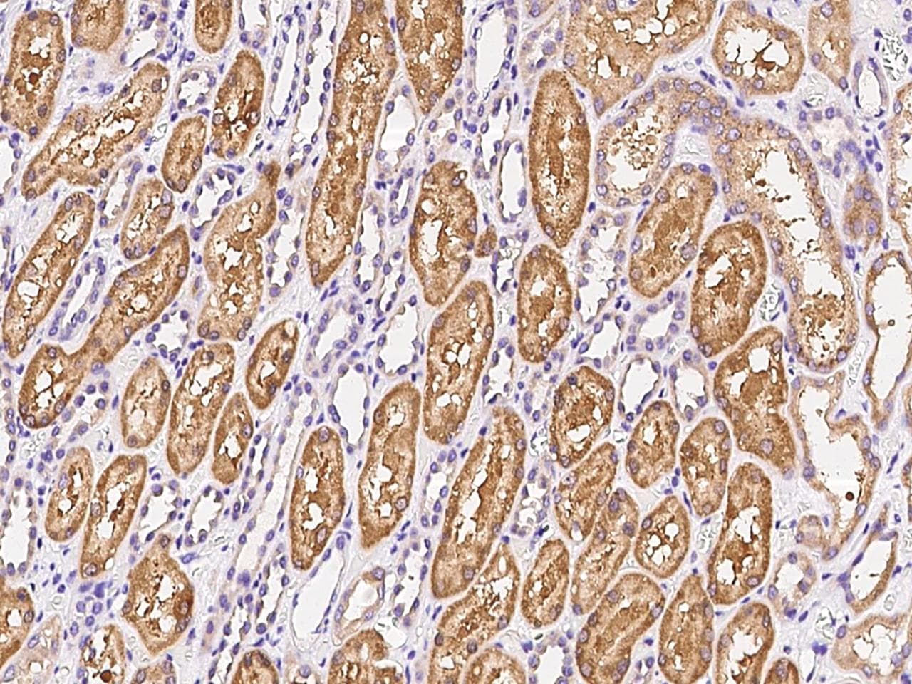 HHLA2 Antibody