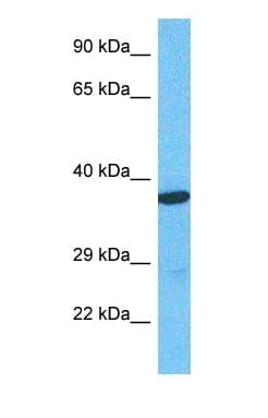 PathPlus™ SLC9A3R1 / NHERF1 / EBP50 Antibody (N-Terminus)