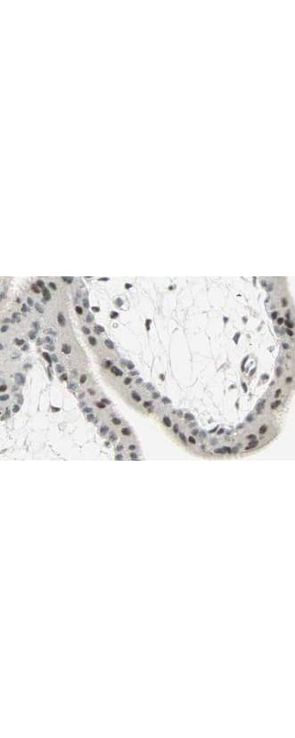 Polyclonal Rabbit anti-Human SMAD3 Antibody (C-Terminus, IHC, WB)