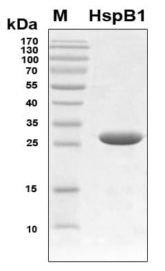 Human HSPB1 / HSP27 Protein (Recombinant 6His, N-terminus)