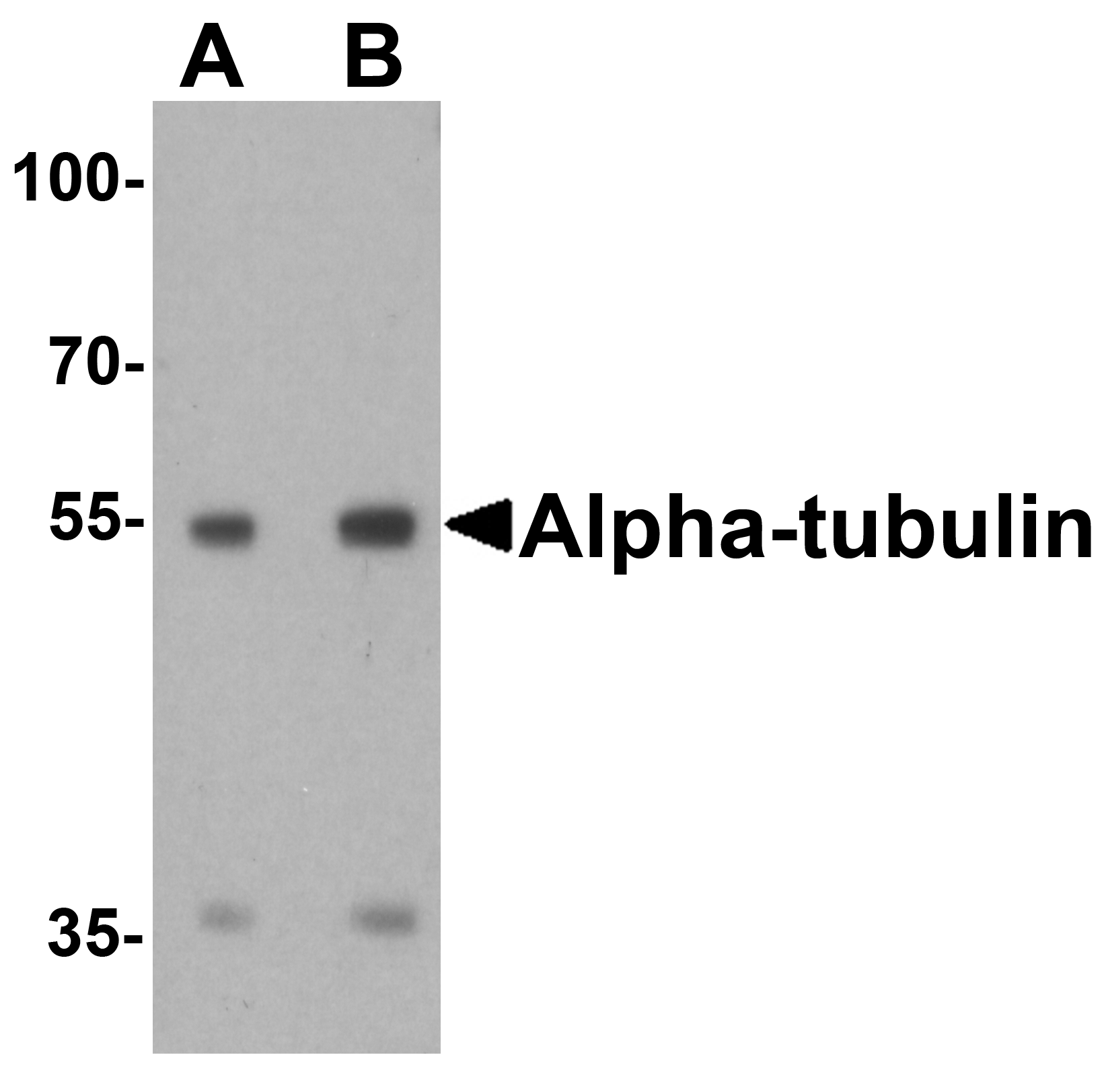 IHC-plus™ TUBA1A / Tubulin Alpha 1a Antibody