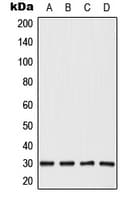 CABYR Antibody (Internal)