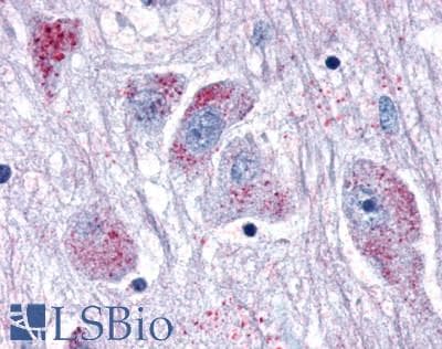 PathPlus™ Polyclonal Rabbit anti-Human GPR80 / GPR99 / OXGR1 Antibody (Extracellular Domain, IHC)