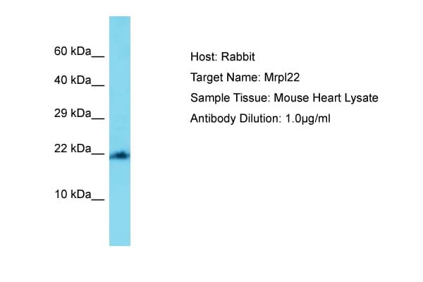 MRPL22 Antibody (aa108-157)