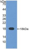 Alpha-Fetoprotein Antibody (aa31-171)