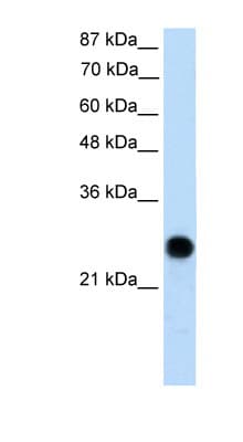 VDAC2 Antibody (N-Terminus)