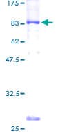 Human LGI1 Protein (Recombinant GST)