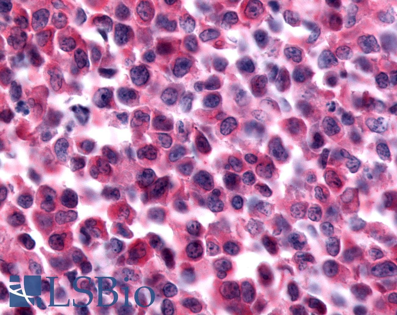 PathPlus™ PAK7/PAK5 Antibody (Internal)