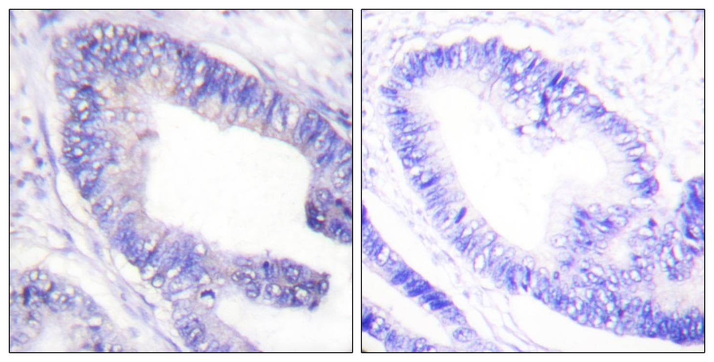 Polyclonal Rabbit anti-Human IRS1 Antibody (phospho-Ser1101, IHC, WB)