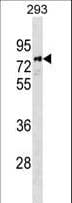 PARP6 Antibody (aa510-538)
