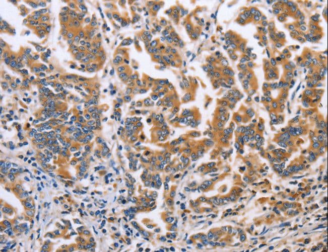 DOK4 Antibody