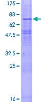 Human OMD / Osteomodulin Protein (Recombinant GST)